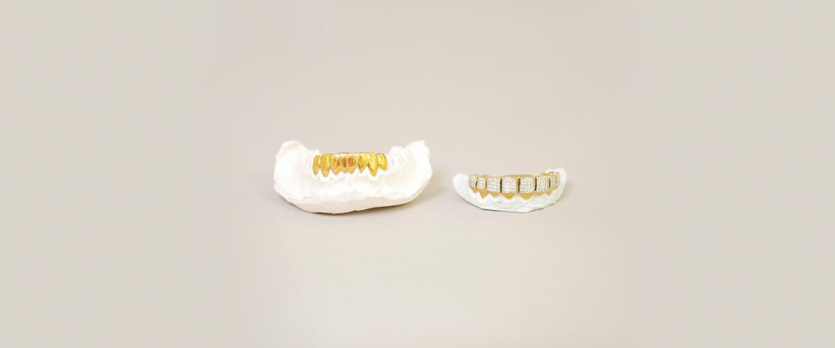   A gold and diamond grill on a dental mold. 
