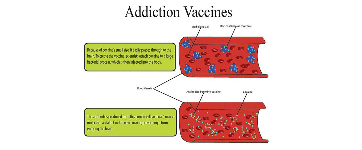 A graphic illustrating how a cocaine vaccine works