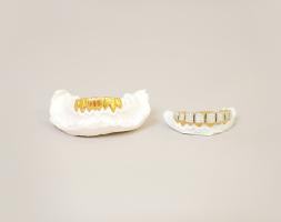 A gold and diamond grill on a dental mold. 